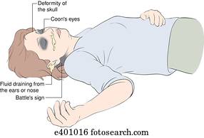 signs of trauma signs of trauma