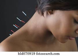 agulhas acupuntura, em, africano, costas mulher