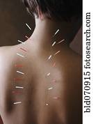 agulhas acupuntura, em, africano, costas mulher