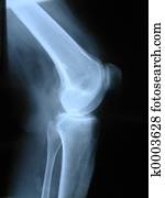 X-ray X-ray