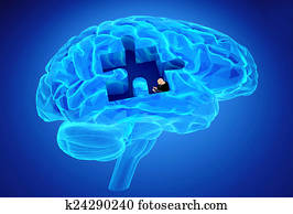 dementia, choroba, a, jeden, prehra, od, um, účinkovať, a, memories
