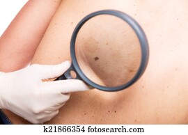 closeup, de, um, pele, exame