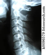 neck x-ray neck x-ray