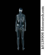 xray,, רנטגן, של, ה, בן אנוש, נקבה, body.