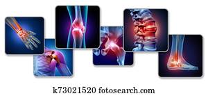 Pain Of The Joints Pain Of The Joints