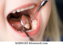 Child Dental Check-Up