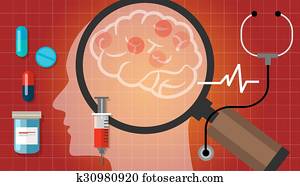 alzheimer, parkinson, schlagen krebs schädel, medikation, koerperbau, medizinische gesundheit, sorgfalt, heilung, krankheit