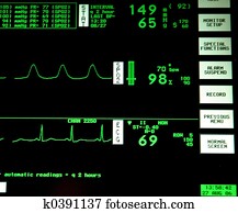 Monitor Monitor