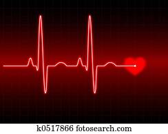 ECG #2 ECG #2
