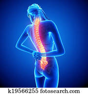 Female back pain anatomy Female back pain anatomy