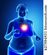 dicker, frau, mit, herz- problem