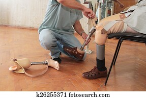Prosthesis Prosthesis