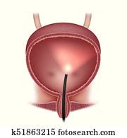 שתני, שלפוחית שתן, בחינה