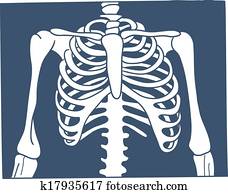 חזה, רנטגן, picture.