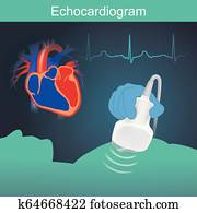 אצ'וכארדיוגראם