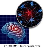 parkinson, cerebro, anatomía, concepto