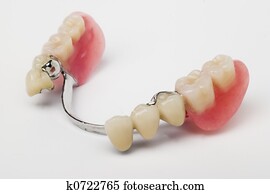 dental prosthesis dental prosthesis