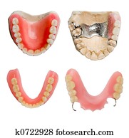 של השיניים, תותבות