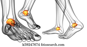 Foot with Malleolus Fractures Unlabeled Drawing | 9795hr_l | Fotosearch