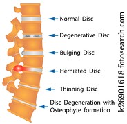 עמוד שדרה, תנאים