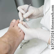Pedicure treatment Pedicure treatment