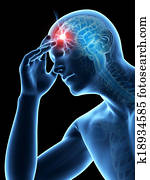 Headache Headache