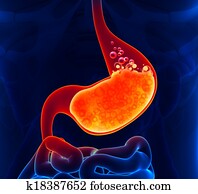 קיבתי, חומצה