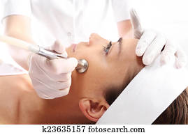 microdermabrasion