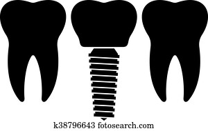 של השיניים, משריש