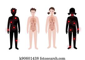 כאב, ב, גוף אנושי