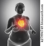 Fat woman with heart issue Fat woman with heart issue