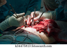 chirurgiens, opération, dans, hôpital