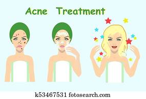 acné, tratamiento, antes, después, piel, problema, solución, vector, ilustración
