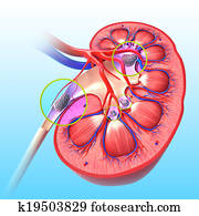 Kidney Stone Stock Photos | Our Top 1000+ Kidney Stone Images | Fotosearch