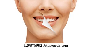 dentes, whitening, before.and.after