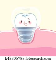 cute, caricatura, dental, implants