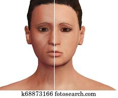 לפני ואחרי, ה, אסתטי, מעבד, של, חידוש נעורים, אחרי, prp, therapy., פרצופי, טיפול של דארמאטולוגיכאל