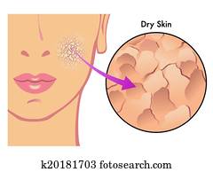 dry skin dry skin