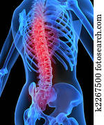 backache illustration backache illustration