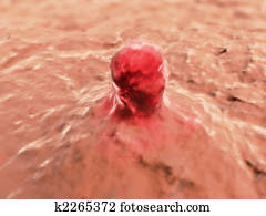 cancer cell cancer cell