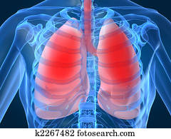 lung infection lung infection