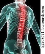 painful spine painful spine