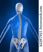 scoliosis scoliosis