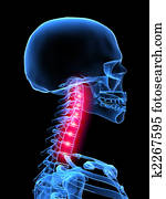 כואב, צוואר