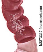 adult pinworm adult pinworm