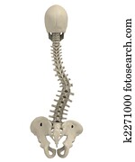 scoliosis scoliosis