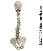 scoliosis scoliosis