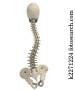 scoliosis scoliosis