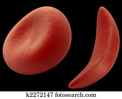 sickle cell sickle cell