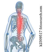 backache, ilustração